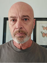 Before using Night Cream