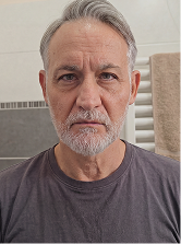 Before using Night Cream