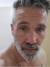 Before using Night Cream
