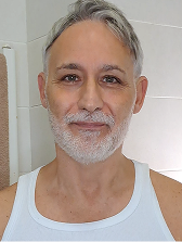 Results after five months using Night Cream